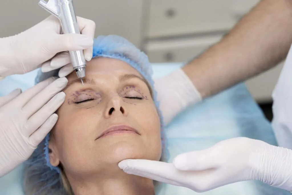 Blefaroplastia en Madrid con el Dr. César Casado. Cirugía de párpados para rejuvenecer la mirada