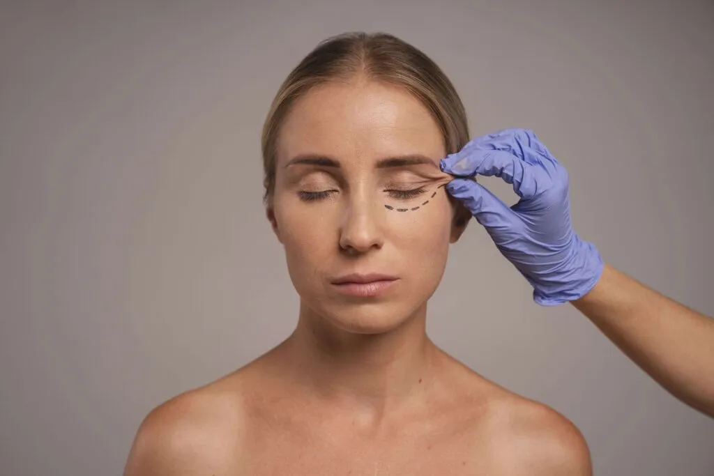 Blefaroplastia en Madrid con el Dr. César Casado. Cirugía de párpados para rejuvenecer la mirada con resultados naturales, seguros y personalizados.