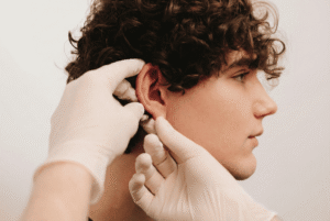 Resultado tras otoplastia en Madrid: orejas más pegadas, simetría mejorada y aspecto natural.