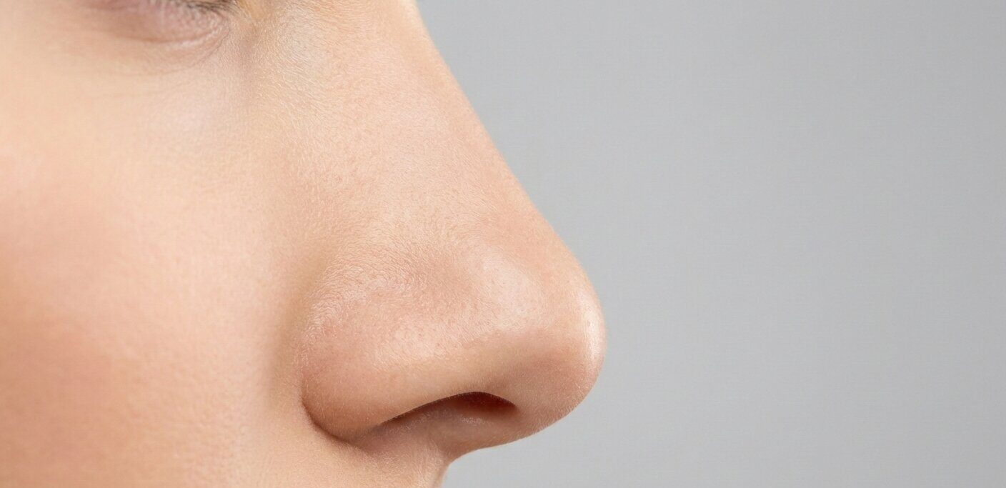 Detalle del perfil de la nariz antes de una rinoplastia ultrasónica