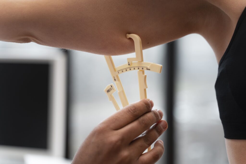 Resultado tras lifting de brazos con cicatriz discreta en la cara interna del brazo y aspecto más firme.