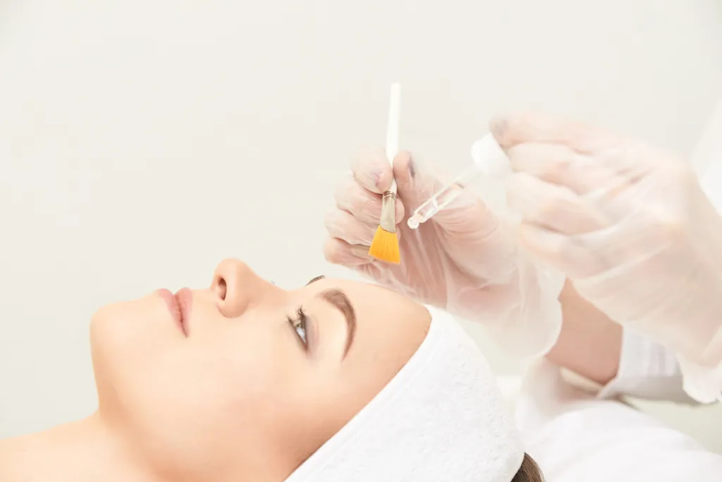 Peeling químico para un rejuvenecimiento facial