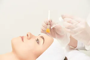 Peeling químico para un rejuvenecimiento facial